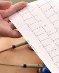 Estudio de electrocardiograma en clínica en El Carmen, Nuevo León. Monterrey.