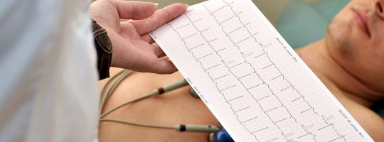 Estudio de electrocardiograma en clínica en El Carmen, Nuevo León. Monterrey.