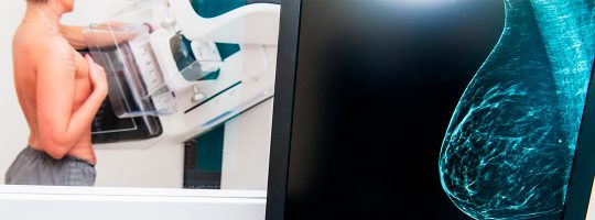 Estudio de Mamografía en clínica en El Carmen, Nuevo León. Monterrey.